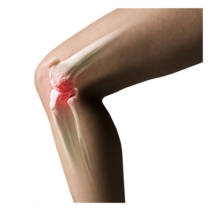 causes joint pain